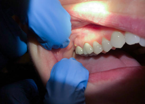 Best Broken or Cracked Tooth Emergency Dentist in Baxley, GA